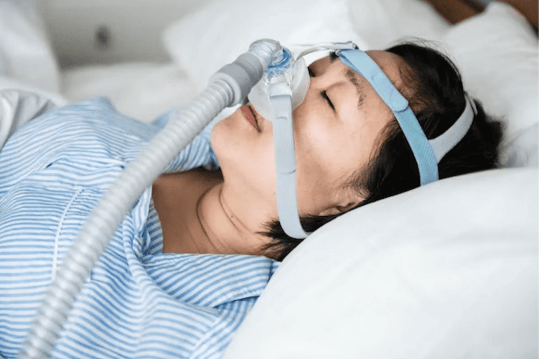 A woman is sleeping on her back wearing a CPAP mask with a head strap and breathing tube, indicating treatment for sleep apnea