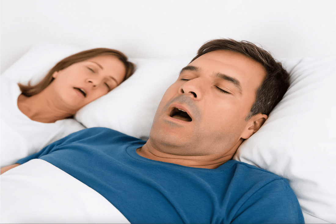 A man and woman are sleeping on their backs with their mouths open, possibly indicating snoring or mouth breathing during sleep