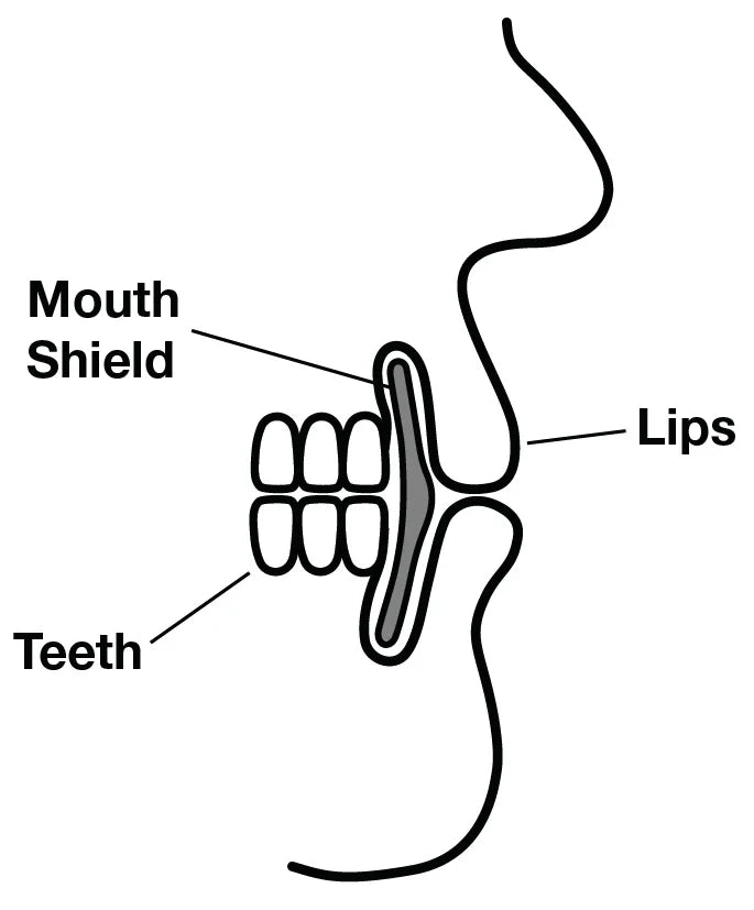 Mouth Shield - MouthShield