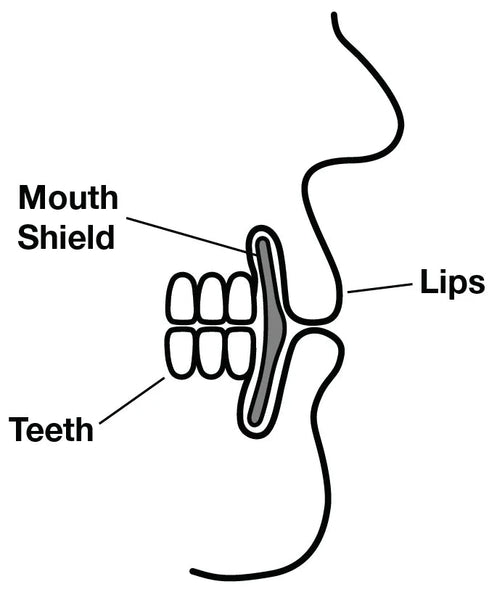 Mouth Shield - MouthShield